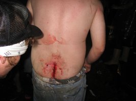 sore-butt.jpg