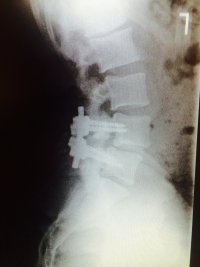 ImageUploadedByTapatalk1405657440.992933.jpg ImageUploadedByTapatalk1405657440.992933.jpg