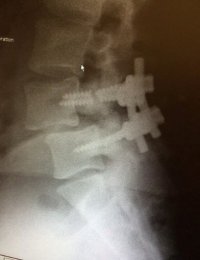 ImageUploadedByTapatalk1405657464.944480.jpg ImageUploadedByTapatalk1405657464.944480.jpg