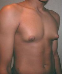 gyno1.jpg