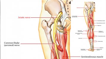 Sciatic-Nerve.jpg