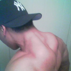 epalad