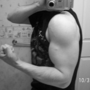 Recent arm shot.