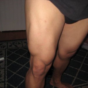 quad