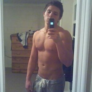 Just me. Will get more updated pictures after Scaphoid Surgery.