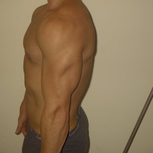 armshot