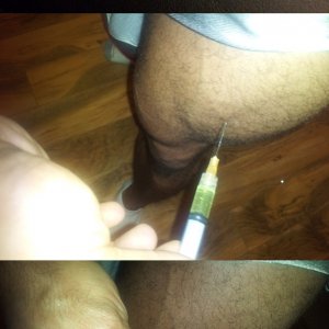 1 ml quad inj. w/Triple X