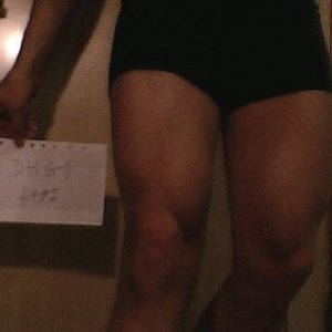 DHG's leg shot