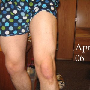 Progress -