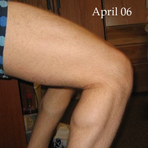 Legs1