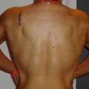 Back10