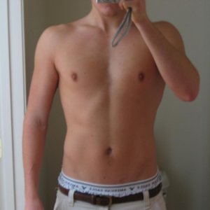 176 10%bf 1 week post H-drol