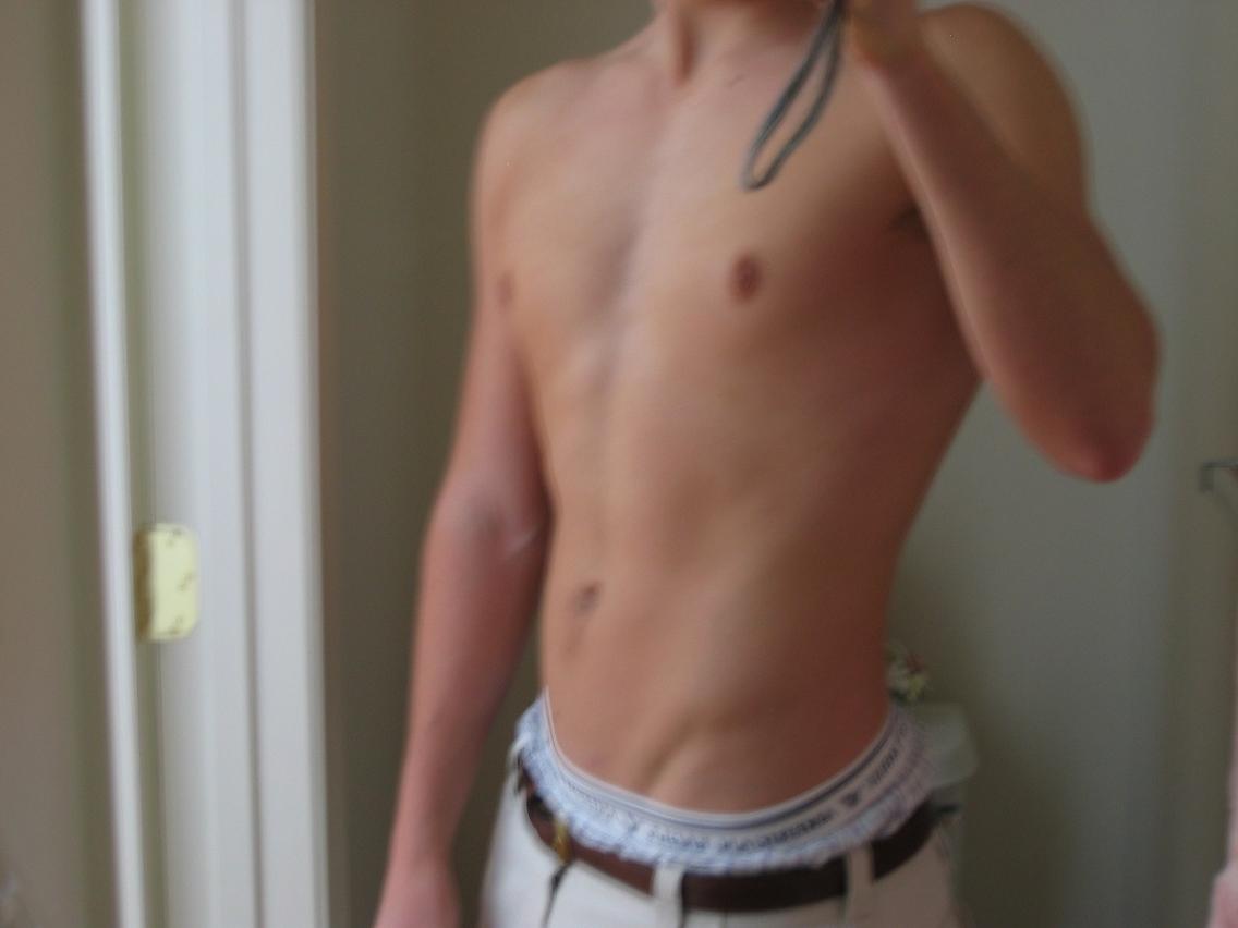 176 10%bf 1 week post H-drol