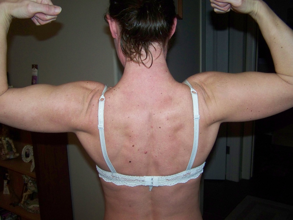 back - before