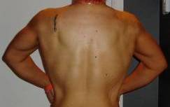 Back10