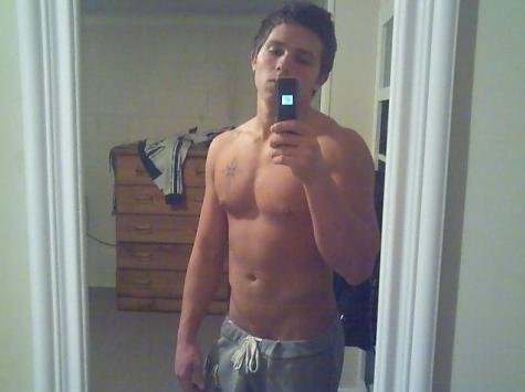 Just me. Will get more updated pictures after Scaphoid Surgery.