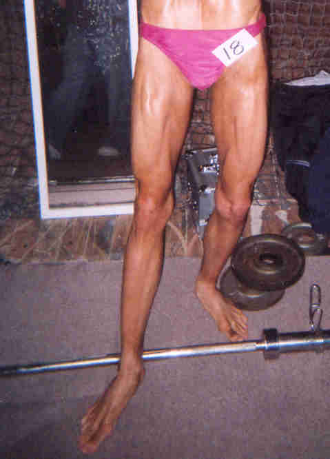 Legs