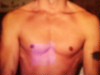 Me,back before i had rotator cuff surgery