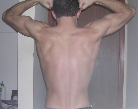 My Back
