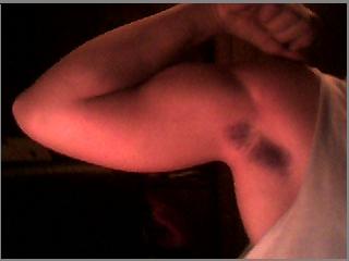 NEW_ARM
