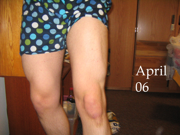 Progress -