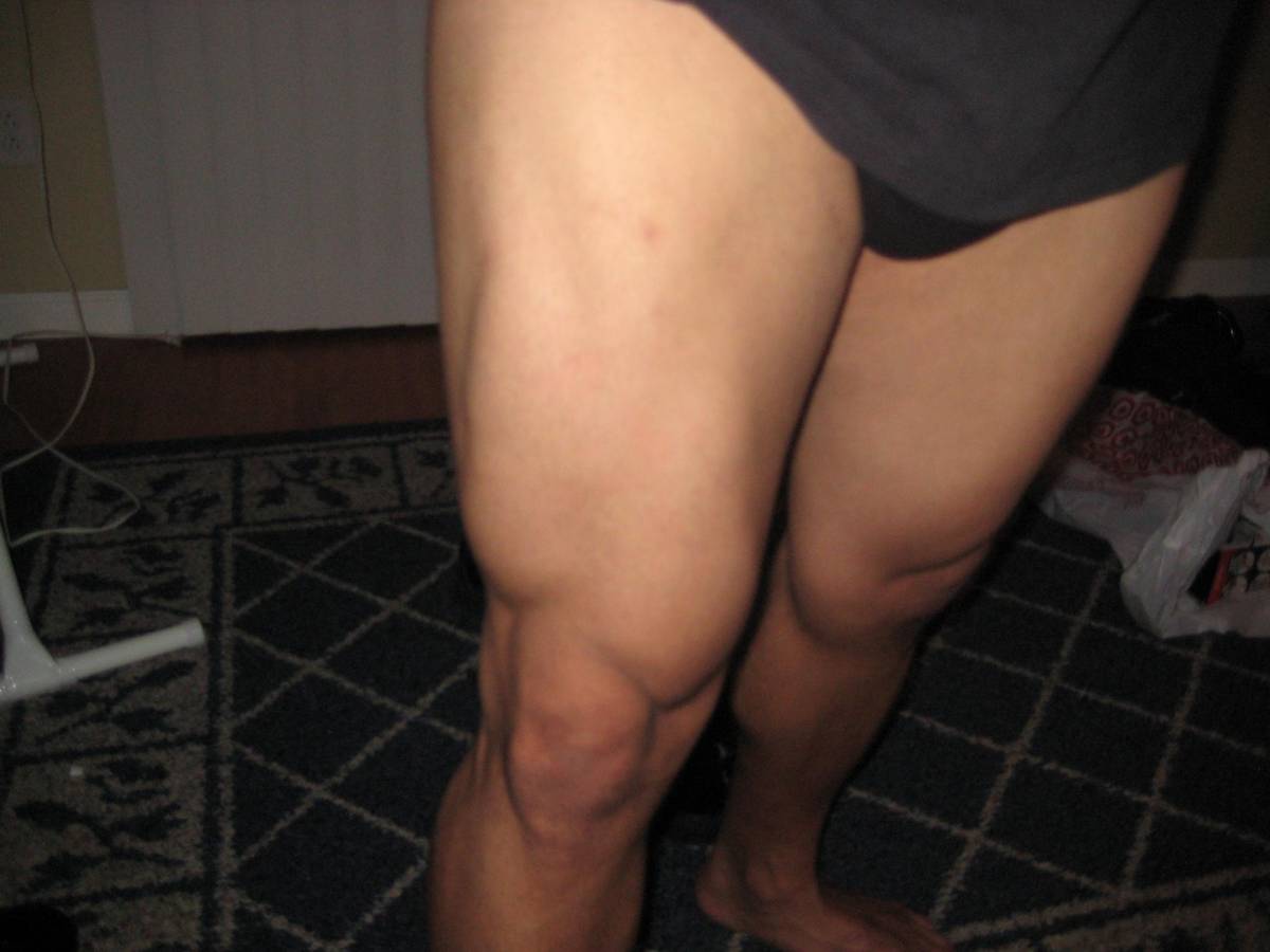 quad