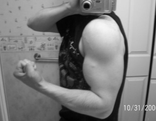 Recent arm shot.