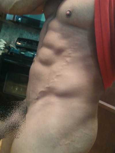 Weird vein