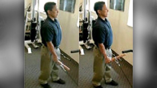 Radial flexion