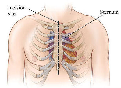 sternum-click.jpg