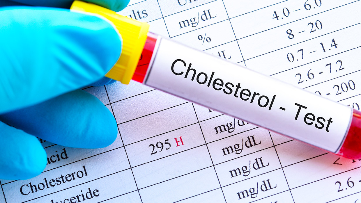 Cholesterol Test