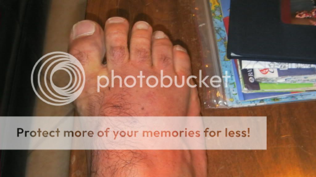foot.jpg