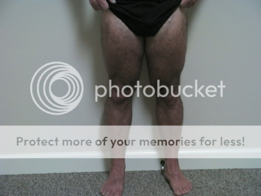 legsfront.jpg