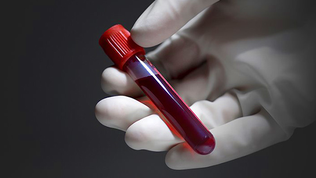 Testosterone-Blood-Tests-Are-Garbage Testosterone-Blood-Tests-Are-Garbage