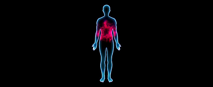 Inflammation Inflammation