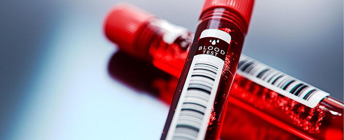 Blood-Tests Blood-Tests