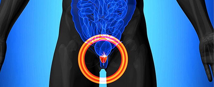 Prostate-Health-Bodybuilding Prostate-Health-Bodybuilding