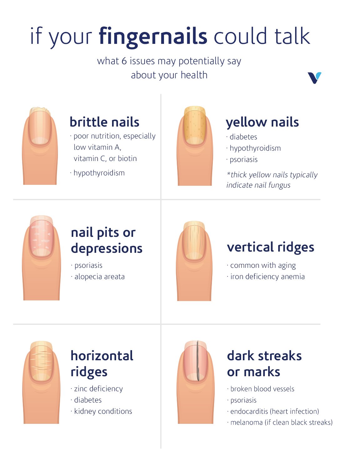 6-Fingernail-Issues-infographic-1.jpg