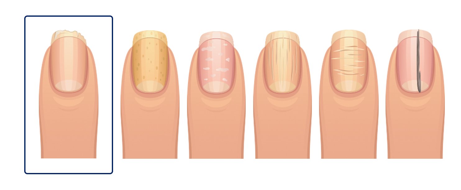 fingernails-1.jpg