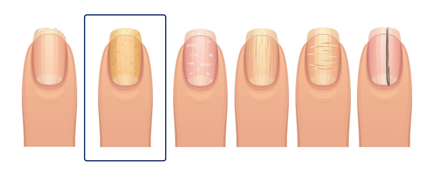 fingernails-2.jpg