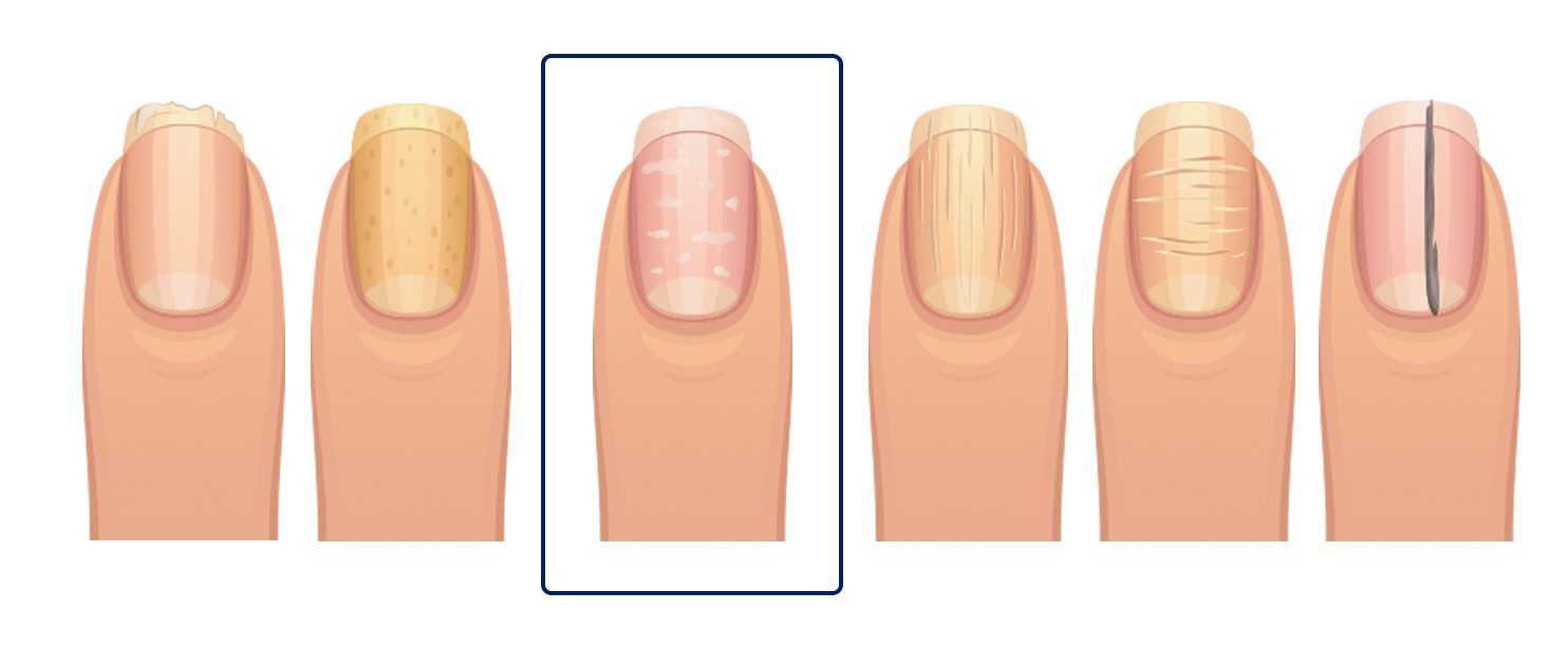 fingernails-3.jpg