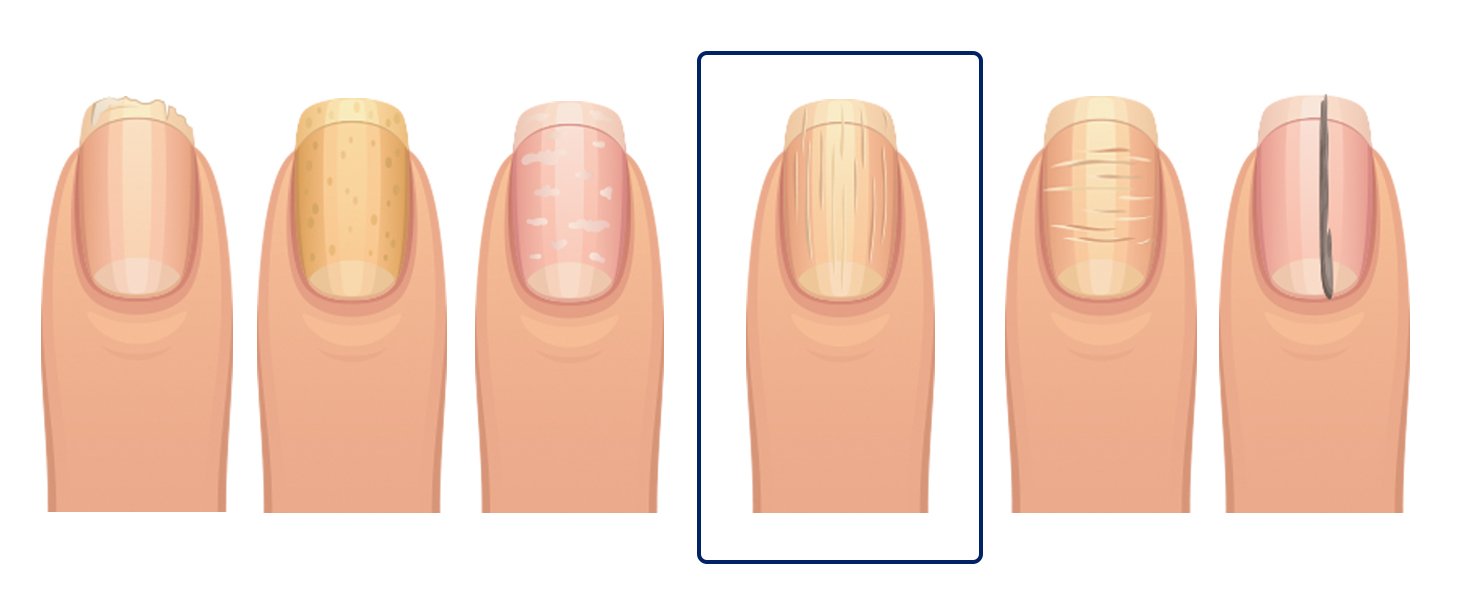 fingernails-4.jpg