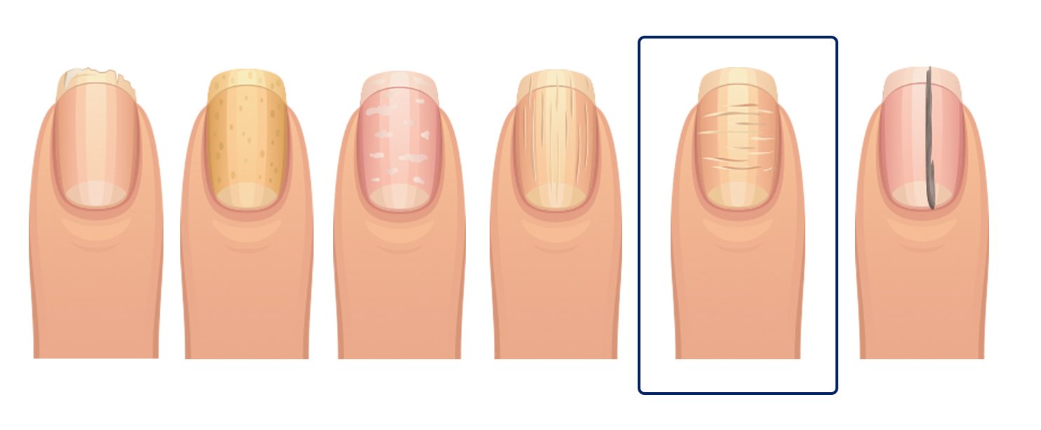 fingernails-5.jpg
