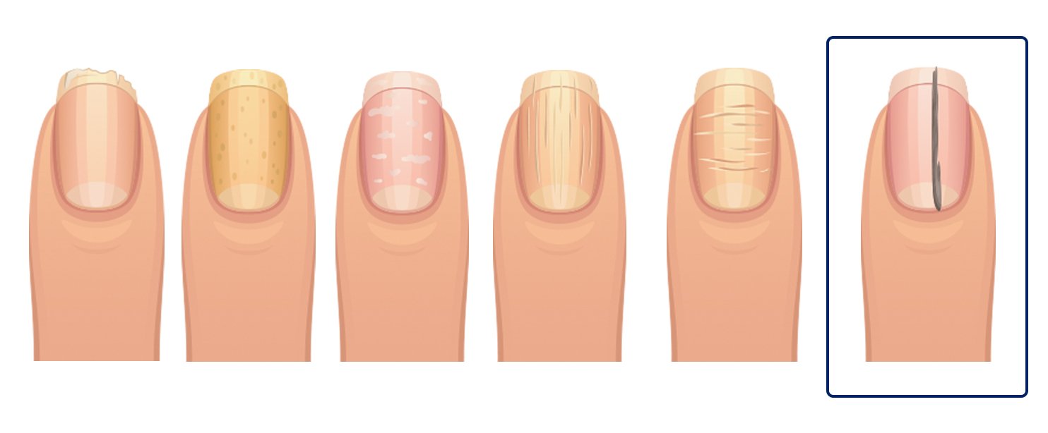 fingernails-6.jpg